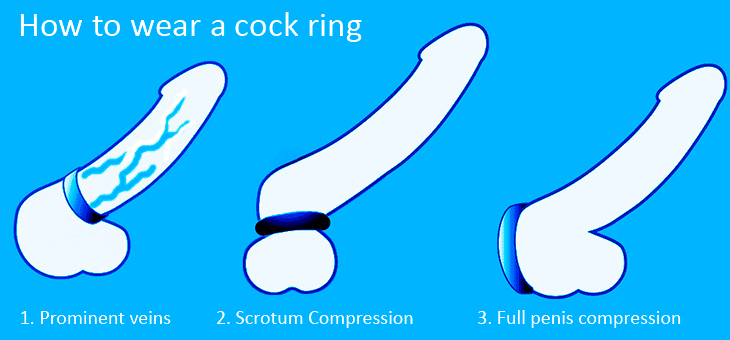 How to use a constrictor ring
