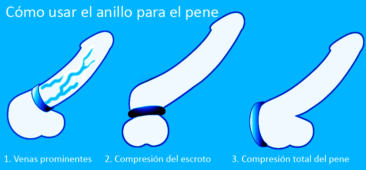 Cómo usar un anillo constrictor